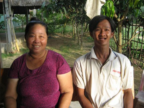 Suốt 29 năm qua, anh Nguyễn Văn Hây, ngụ ấp Cả Răng, xã Bình Phú, huyện Tân Hồng, tỉnh Đồng Tháp bị gọi là “người đàn ông rắn” vì anh bị lột da liên tục. Và cũng từng ấy năm, anh không hề mọc một cái răng nào. (Ảnh: Anh Hây ngồi cạnh mẹ)