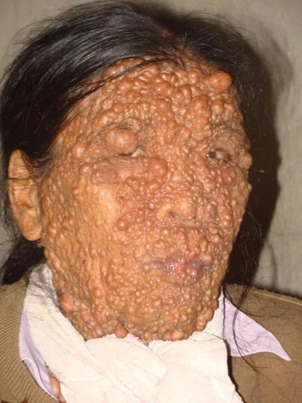 chuyện lạ,chuyện lạ việt nam,phi thường,kỳ quặc,bệnh lạ