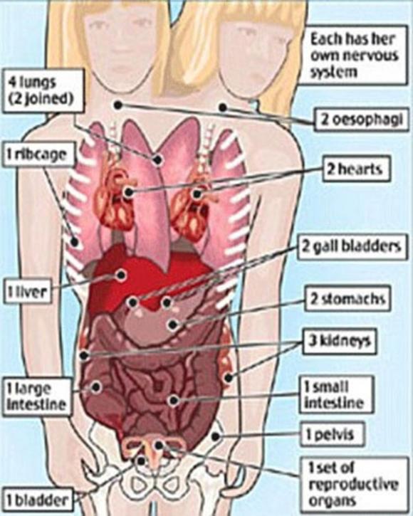 Chuyện lạ,chuyện lạ thế giới,phi thường,kỳ quặc,cô gái 2 đầu
