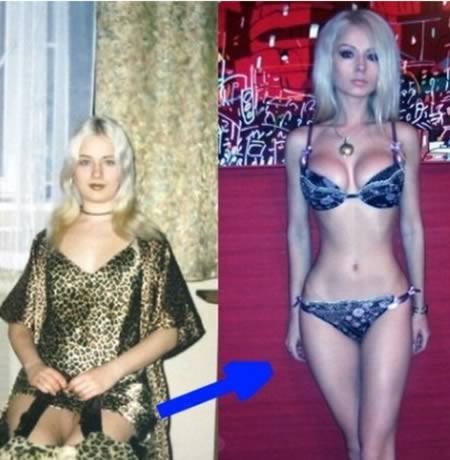 Chuyện lạ,chuyện lạ thế giới,phi thường,kỳ quặc,phẫu thuật