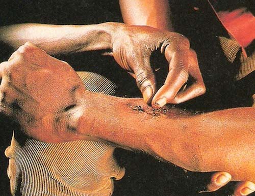 Chuyện lạ,chuyện lạ thế giới,phi thường,kỳ quặc,chữa bệnh