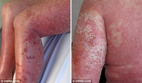 Chuyện lạ,chuyện lạ thế giới,phi thường,kỳ quặc,lột da