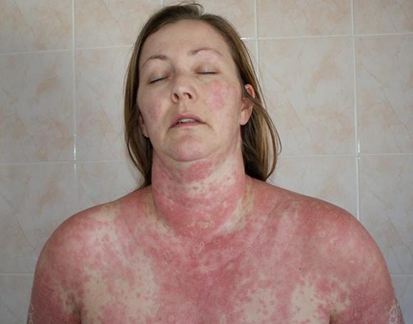 Chuyện lạ,chuyện lạ thế giới,phi thường,kỳ quặc,lột da