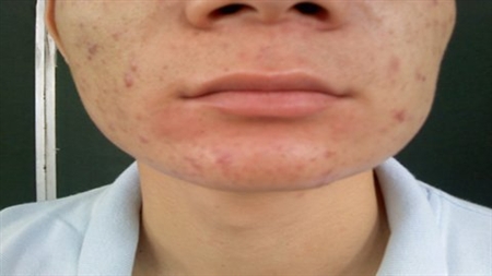 chuyện lạ,chuyện lạ việt nam,phi thường,kỳ quặc