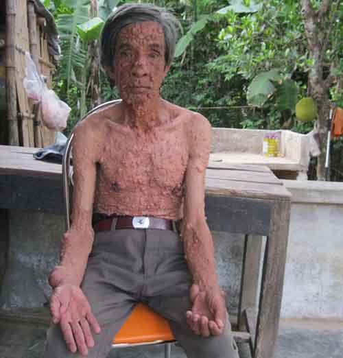 chuyện lạ,chuyện lạ việt nam,phi thường,kỳ quặc,dị nhân