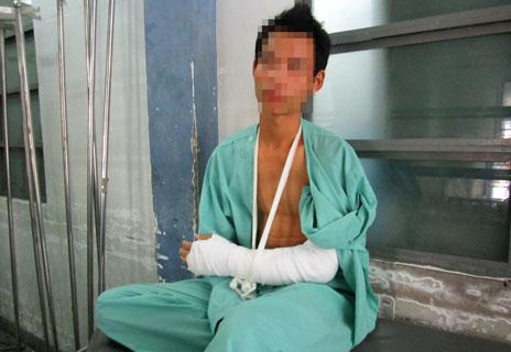 Vụ án,Cướp tài sản,Chặt tay cướp tài sản