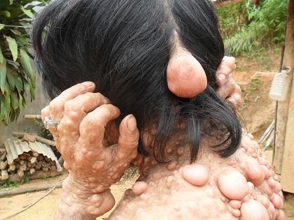 chuyện lạ,chuyện lạ việt nam,phi thường,kỳ quặc,dị nhân