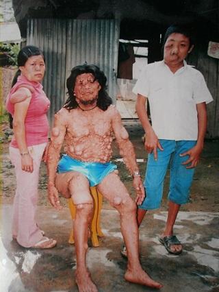 chuyện lạ,chuyện lạ việt nam,phi thường,kỳ quặc,dị nhân