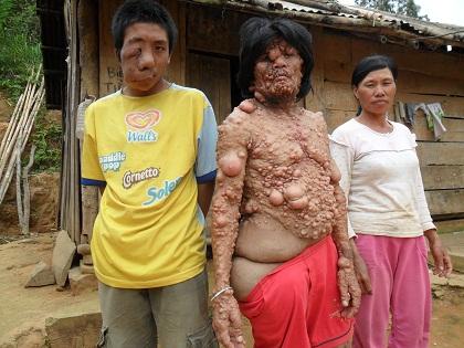 chuyện lạ,chuyện lạ việt nam,phi thường,kỳ quặc,dị nhân