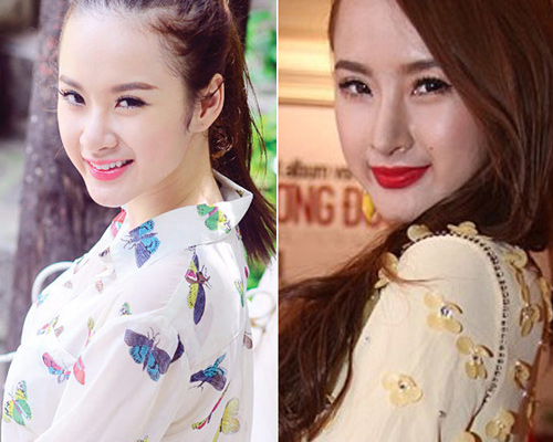 Sao việt,sao việt phẫu thuật thẩm mỹ,Đinh Ngọc Diệp,Ngọc quyên,Angela Phương trinh
