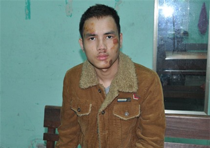 Vụ án,Nam thanh niên,chém người,côn đồ