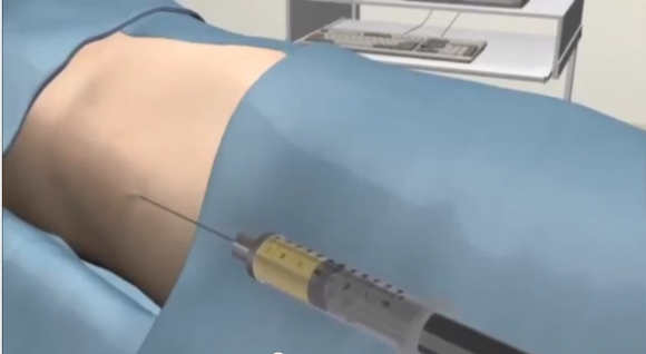 Thẩm mỹ,nâng ngực,bác sĩ,phái đẹp
