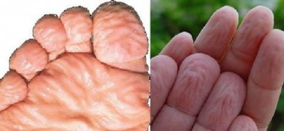 Quá trình xác chết phân hủy,Chết đuối,Y học,Phân hủy xác chết