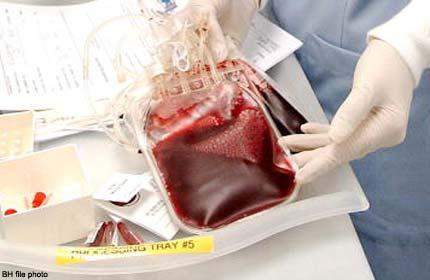 Truyền máu,Truyền máu nhiễm HIV,Virus HIV