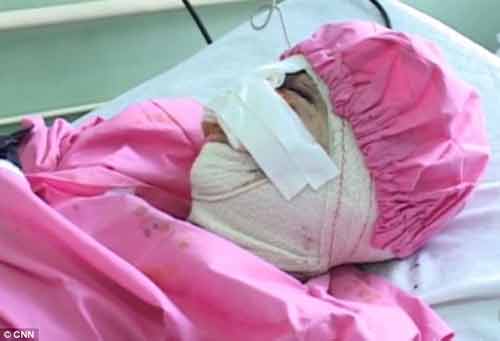 cắt môi vợ,gã chồng tệ bạc,phụ nữ Afghanistan,nghiện heroin