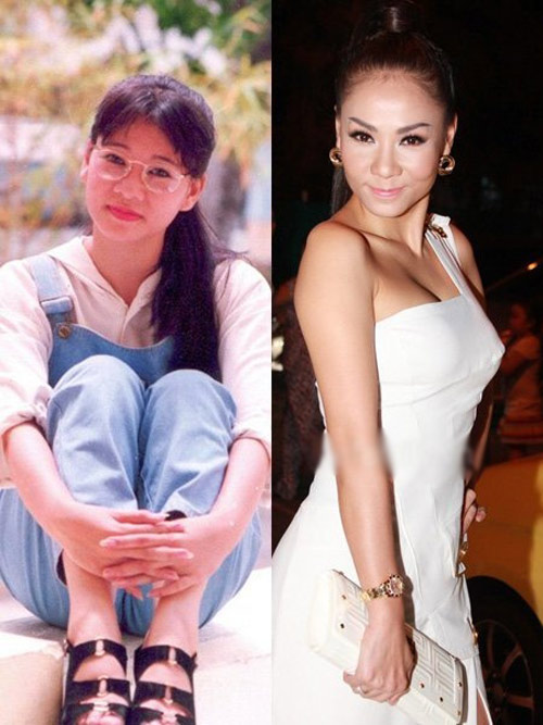 Thu Minh,Ca sĩ Thu Minh,Thu Minh sửa mũi