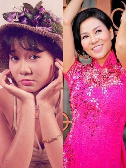 Thu Minh,Ca sĩ Thu Minh,Thu Minh sửa mũi