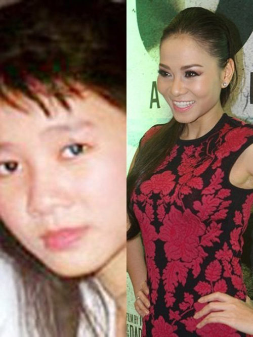 Thu Minh,Ca sĩ Thu Minh,Thu Minh sửa mũi