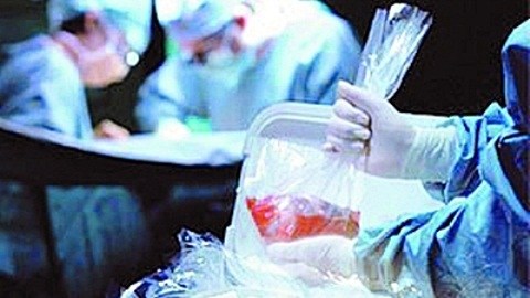 mổ nội tạng người,ăn cắp nội tạng,chuyện hoang mang trên mạng,