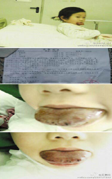 Chuyện lạ 4 phương,chuyện lạ thế giới,phi thường,kỳ quặc,3 tuổi có lưỡi khổng lồ