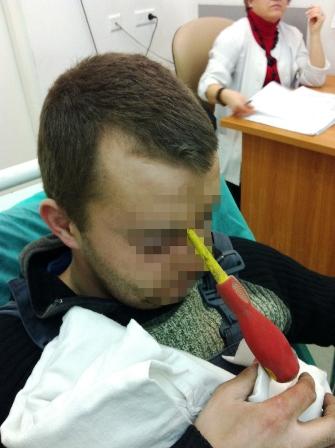Chuyện lạ 4 phương,chuyện lạ thế giới,phi thường,tua vít đâm xuyên trán
