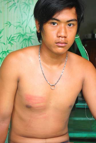 Hào Anh,Vụ tra tấn dã man bé Hào Anh,Hào Anh ăn trộm,Bạo hành trẻ em