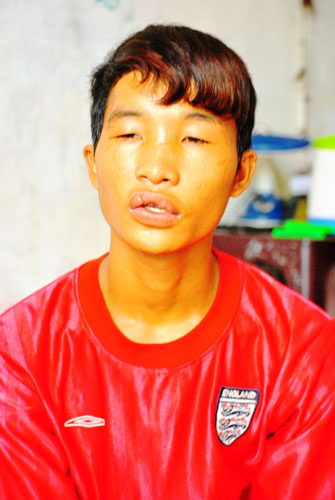 Hào Anh,Vụ tra tấn dã man bé Hào Anh,Hào Anh ăn trộm,Bạo hành trẻ em