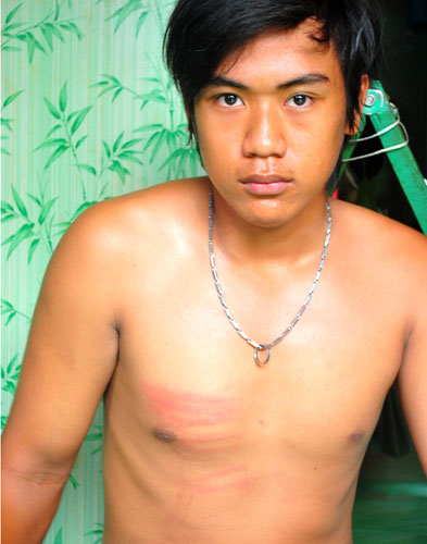 Hào Anh,Vụ tra tấn dã man bé Hào Anh,Hào Anh ăn trộm,Bạo hành trẻ em
