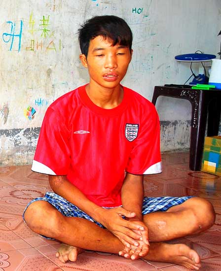 Hào Anh,Vụ tra tấn dã man bé Hào Anh,Hào Anh ăn trộm,Bạo hành trẻ em