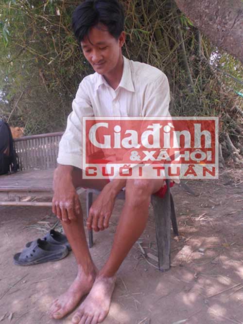 Chuyện lạ 4 phương,chuyện lạ thế giới,phi thường,dị nhân