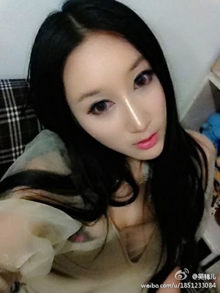 sao thẩm mỹ,sao độn cằm,sao gọt mặt