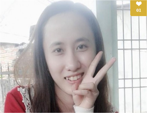 Let’s Beauty, Phẫu thuật thẩm mỹ toàn diện, Phẫu thuật thẩm mỹ miễn phí, Viện thẩm mỹ Khơ Thị