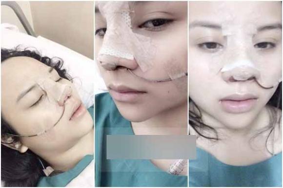 Phẫu thuật thẩm mỹ,giải mã nguyên nhân công khai phẫu thuật thẩm mỹ của giới trẻ