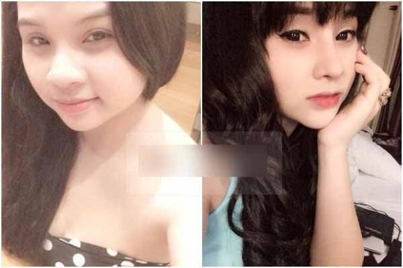 Phẫu thuật thẩm mỹ,giải mã nguyên nhân công khai phẫu thuật thẩm mỹ của giới trẻ