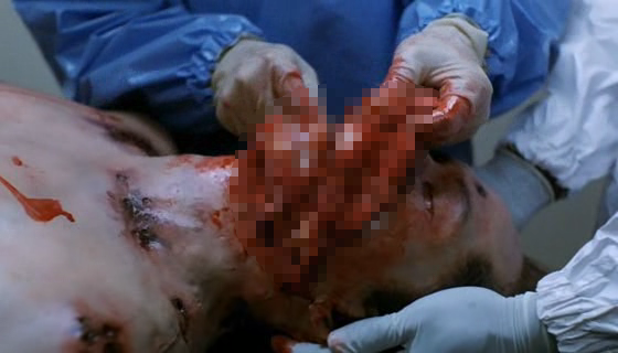 Bệnh dịch,bệnh dịch Ebola,rợn người cảnh chết chóc ở tâm đại dịch Ebola