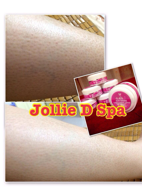Spa Jollie D, viêm nang lông, Điều trị viêm nang lông, Thẩm mỹ viện điều trị viêm nang lông