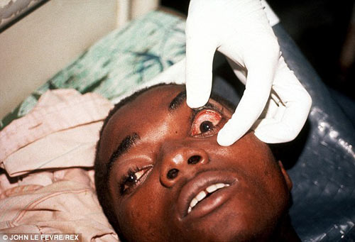 Bệnh Ebola,Thái Lan phát hiện 21 du khách nhiễm bệnh Ebola