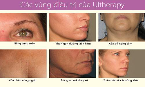 Thẩm mỹ Quốc tế Bally, Giảm béo, Thẩm mỹ viện làm đẹp, Thẩm mỹ viện uy tín, Trẻ hóa da