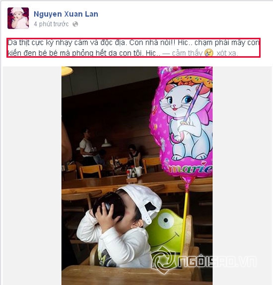 Xuân Lan,bé Thỏ,con gái Xuân Lan,bé Thỏ bị kiến đốt phỏng da,mẹ con siêu mẫu Xuân Lan đón sinh nhật