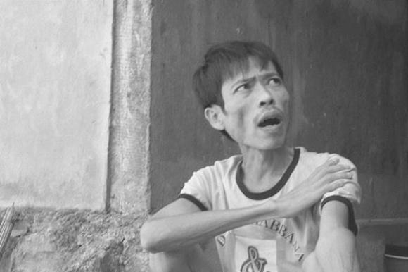 Mật cóc,nuốt mật cóc chữa bênh ung thư,thực hư chuyện nuốt mật cóc chữa bệnh ung thư