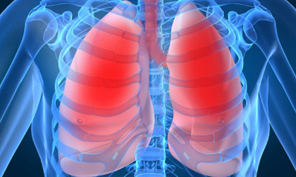 phổi, bệnh phổi, sức khoẻ