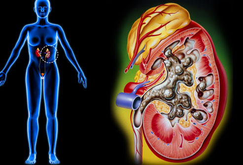 Đau bụng,đau bụng dưới,nguyên nhân gây đau bụng dưới ở phụ nữ