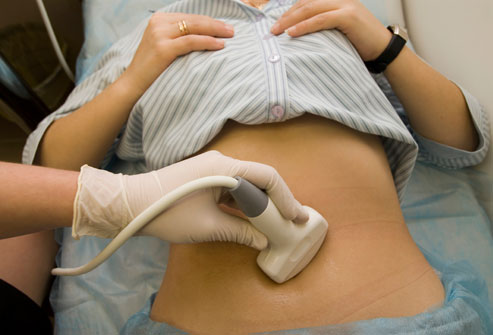 Đau bụng,đau bụng dưới,nguyên nhân gây đau bụng dưới ở phụ nữ