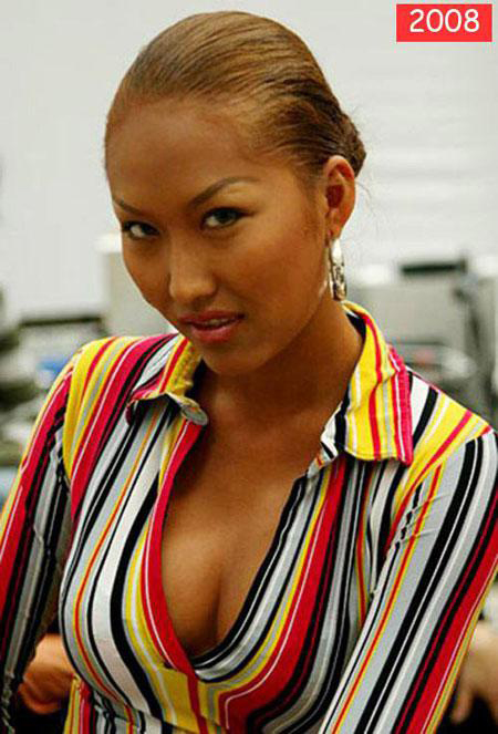 Mimi spa, Phẫu thuật thẩm mỹ uy tín, Phẫu thuật làm đẹp, Thẩm mỹ uy tín