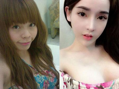 Mimi spa, Phẫu thuật thẩm mỹ uy tín, Phẫu thuật làm đẹp, Thẩm mỹ uy tín