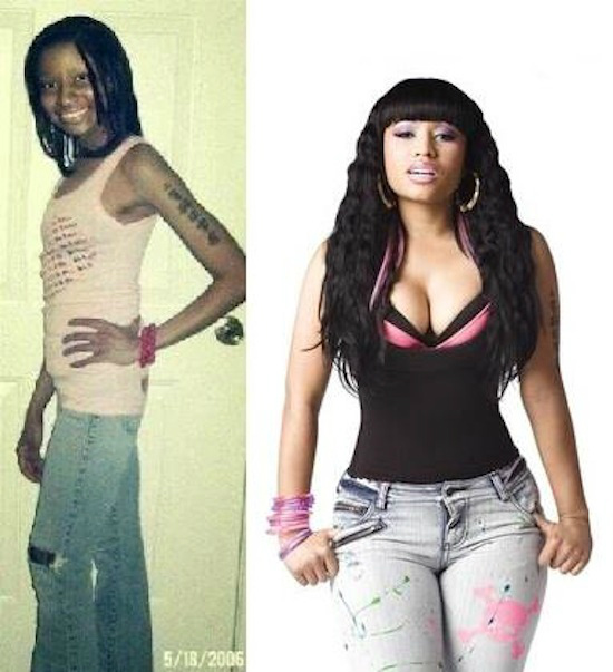 Sự khác biệt khó tin của Nicki Minaj trước khi 'độn' nhựa toàn thân