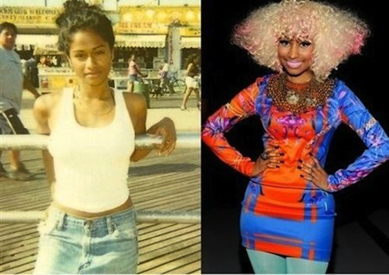Nicki Minaj, Nicki Minaj before plastic surgery, Nicki Minaj plastic surgery, singer Nicki Minaj