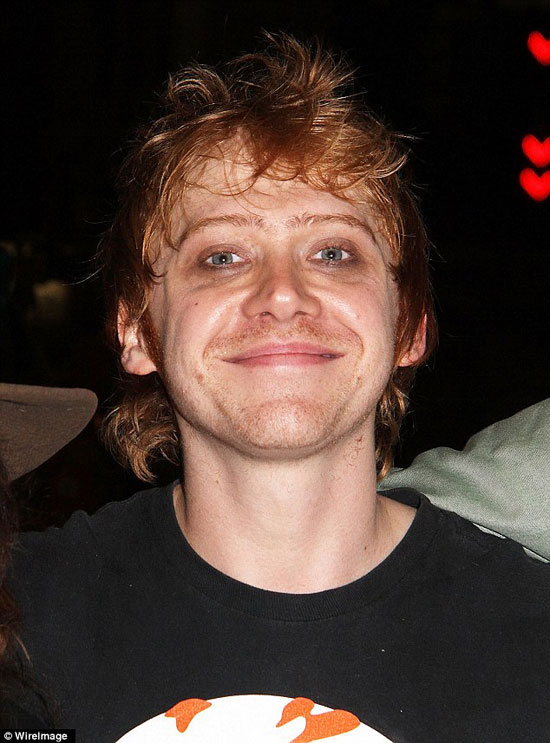 Rupert Grint,sao Harry Potter,Ron,sao Hollywood xấu xí,Rupert Grint mặt hốc hác mắt thâm quầng
