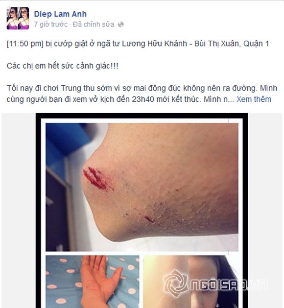Diệp Lâm Anh,Diệp Lâm Anh gặp cướp,sao Việt bị cướp,nạn cướp tại Hồ Chí Minh