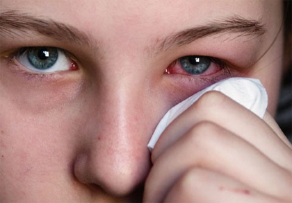 Đau mắt,đau mắt đỏ,tuyệt chiêu trị đau mắt đỏ hữu hiệu bằng khoai tây, mật ong